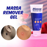 massa(wart) remover gel ( 100g ) pack of 1