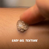 massa(wart) remover gel ( 100g ) pack of 1